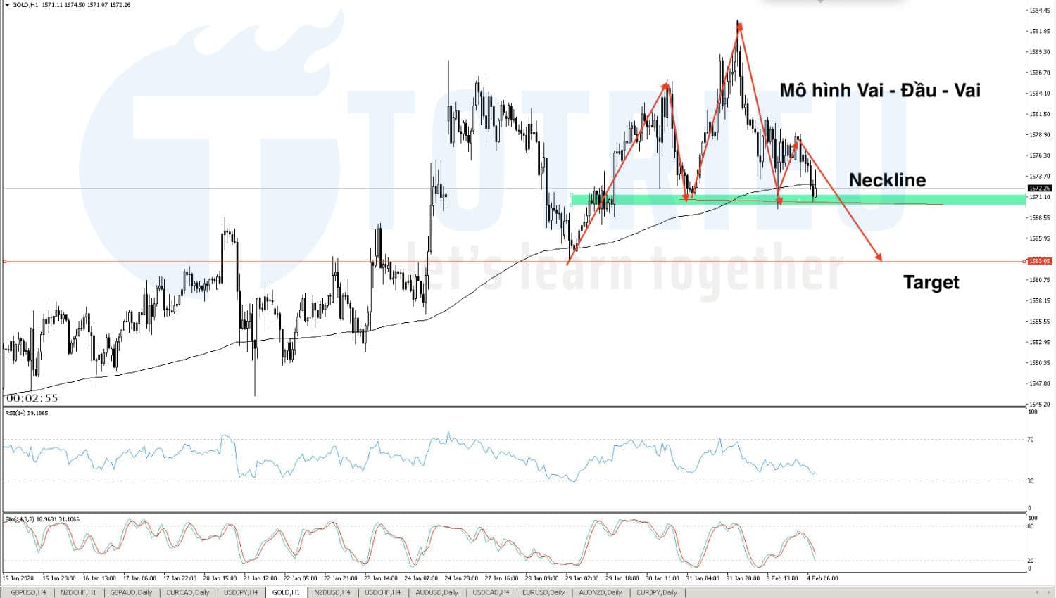 Dự báo giá Vàng (XAU/USD) ngày 04/02/2020