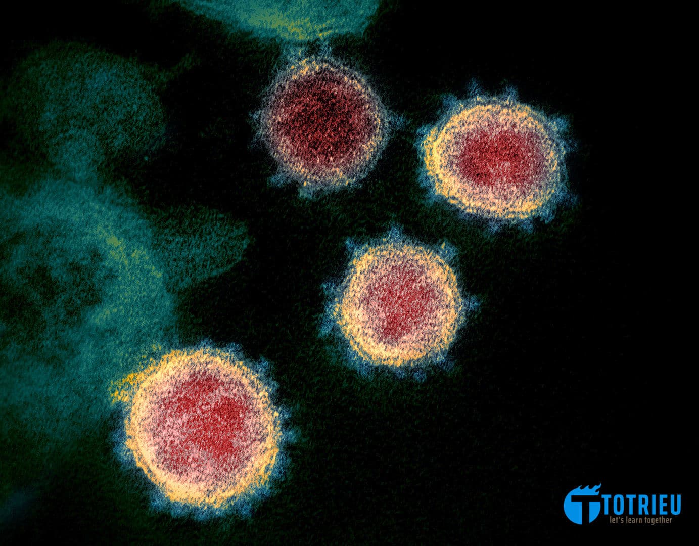 Hình ảnh siêu vi thể hiện SARS-CoV-2. Các gai ở rìa ngoài của các hạt virus giống như một vương miện.