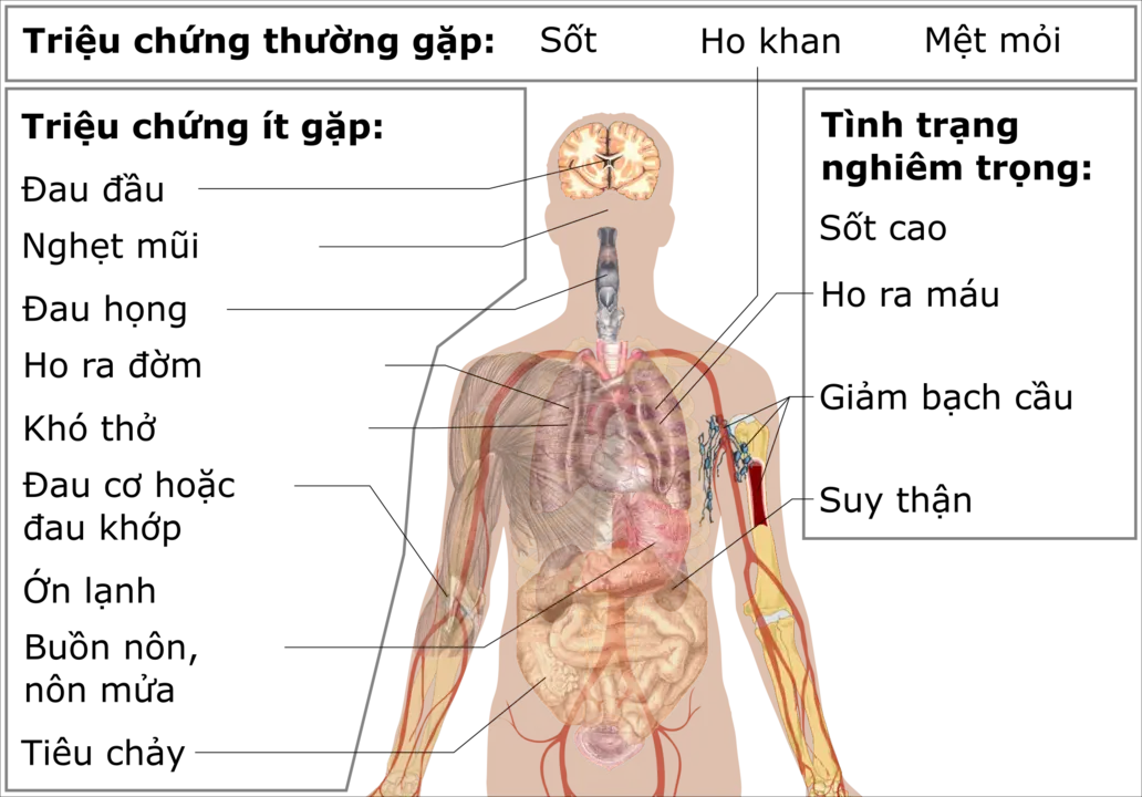 Các triệu chứng của 2019-nCoV. Có báo cáo virus tồn tại trong cơ thể người nhưng không gây triệu chứng.