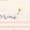 Giá Vàng - XAUUSD ngày 05-05-2023: Cờ tăng xuất hiện